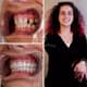 Slider image (10) Dentaray Clinic: luxury Dental Clinic in Istanbul
